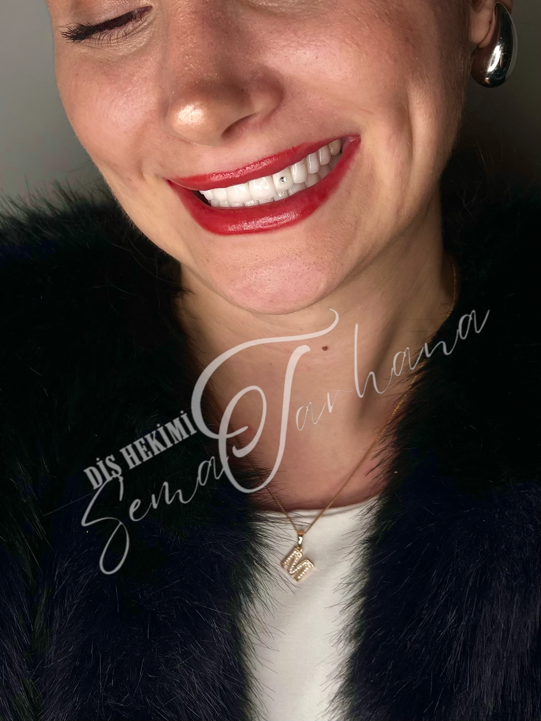 Sema Tarhana Silgu Muayenehanesi