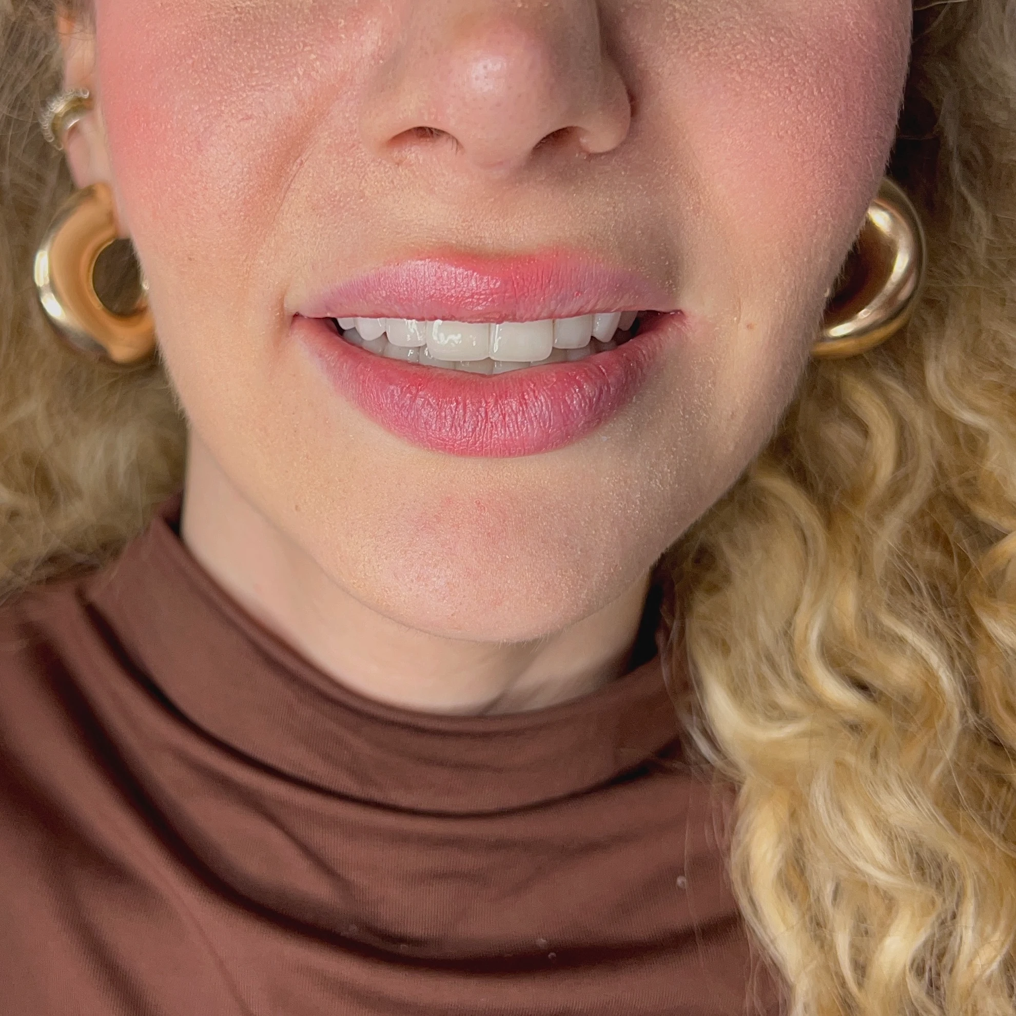 Sema Tarhana Silgu Muayenehanesi