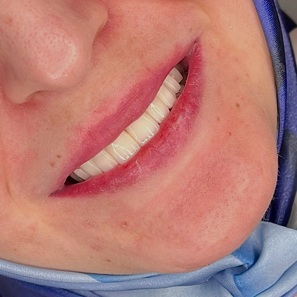 Sema Tarhana Silgu Muayenehanesi