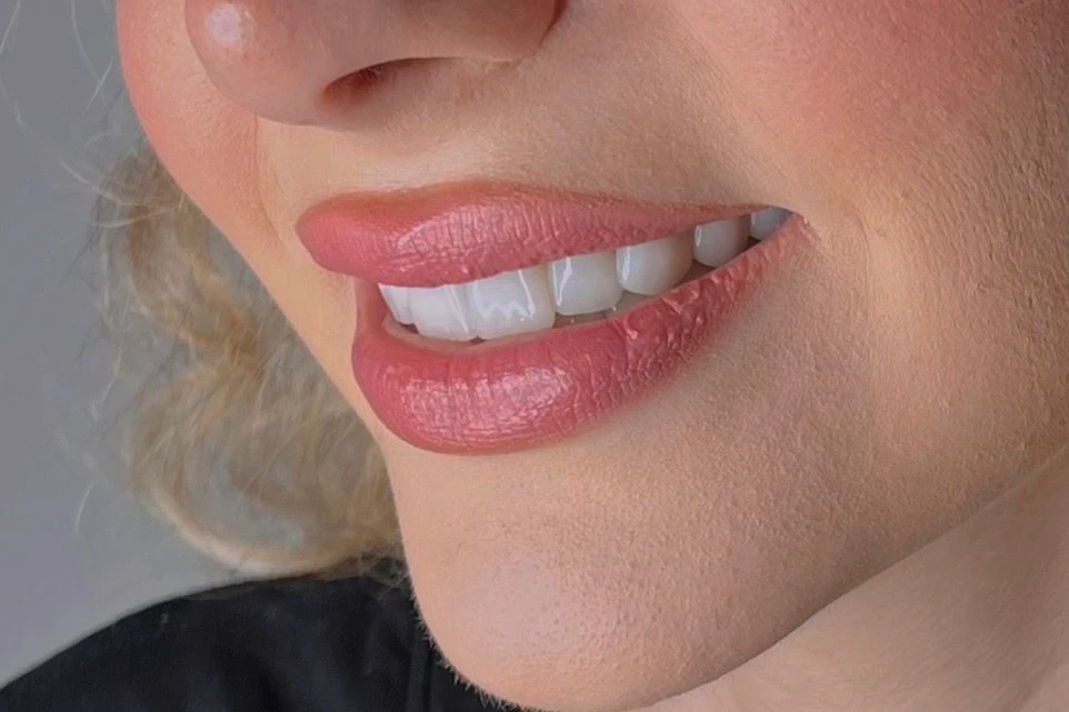 Şeffaf Plak mı,Diş Teli mi?